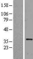 HLF Human Over-expression Lysates NM_002126