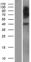 HLAE (HLA-E) Human Over-expression Lysates NM_005516