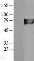 HLCS Human Over-expression Lysates NM_000411