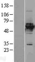 HLX1 (HLX) Human Over-expression Lysates NM_021958