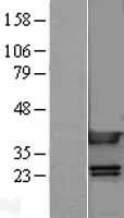 HMG1 (HMGB1) Human Over-expression Lysates NM_002128