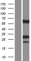 HMGCL Human Over-expression Lysates NM_001166059