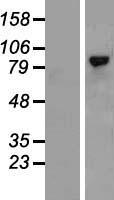 CD168 (HMMR) Human Over-expression Lysates NM_012485