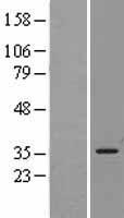 Heme Oxygenase 1 (HMOX1) Human Over-expression Lysates NM_002133