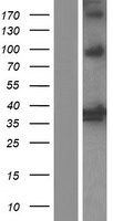 ls003163 heme oxygenase 2 hmox2 human over expression lysates nm 001127205 wb testing 2