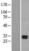 HMX2 Human Over-expression Lysates NM_005519