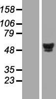 HNF 4 alpha (HNF4A) Human Over-expression Lysates NM_000457