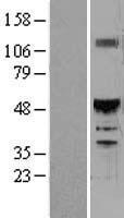 HNF6 (ONECUT1) Human Over-expression Lysates NM_004498