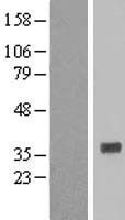 HNMT Human Over-expression Lysates NM_006895