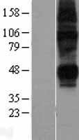 ENT2 (SLC29A2) Human Over-expression Lysates NM_001532