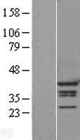 hnRNP A1 (HNRNPA1) Human Over-expression Lysates NM_002136