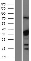hnRNP A1 (HNRNPA1) Human Over-expression Lysates NM_031157