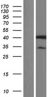 HNRPAB (HNRNPAB) Human Over-expression Lysates NM_031266