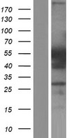 ls003185 hnrnp f hnrnpf human over expression lysates nm 001098208 wb testing 1