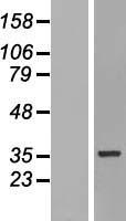 HNRPH3 (HNRNPH3) Human Over-expression Lysates NM_012207