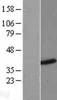 HNRPH3 (HNRNPH3) Human Over-expression Lysates NM_021644