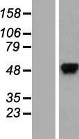 hnRNP K (HNRNPK) Human Over-expression Lysates NM_031262