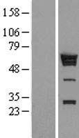 hnRNP K (HNRNPK) Human Over-expression Lysates NM_031263
