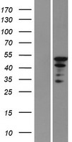 hnRNP L (HNRNPL) Human Over-expression Lysates NM_001005335