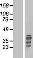 HOX11 (TLX1) Human Over-expression Lysates NM_005521