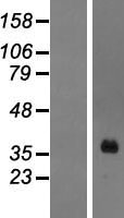 HOXA1 Human Over-expression Lysates NM_005522