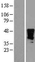 HOXA2 Human Over-expression Lysates NM_006735