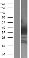 HOXA4 Human Over-expression Lysates NM_002141