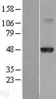 HOXA10 Human Over-expression Lysates NM_018951