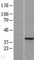 ls003207 hoxa11 human over expression lysates nm 005523 wb testing 1