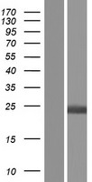 Hippocalcin (HPCA) Human Over-expression Lysates NM_002143