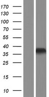 HOXB1 Human Over-expression Lysates NM_002144