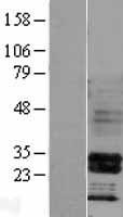 HOXB4 Human Over-expression Lysates NM_024015