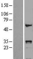 HOXB5 Human Over-expression Lysates NM_002147