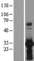 HOXB6 Human Over-expression Lysates NM_018952