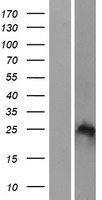 HOXB7 Human Over-expression Lysates NM_004502