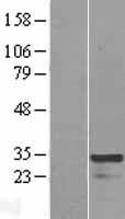 HOXC4 Human Over-expression Lysates NM_014620