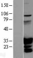 HOXC6 Human Over-expression Lysates NM_004503