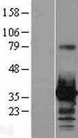 HOXC8 Human Over-expression Lysates NM_022658