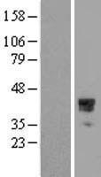 Homeo box C10 (HOXC10) Human Over-expression Lysates NM_017409