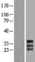 HOXC11 Human Over-expression Lysates NM_014212
