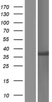 HOXC13 Human Over-expression Lysates NM_017410
