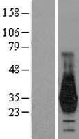 HOXD4 Human Over-expression Lysates NM_014621