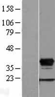 HOXD8 Human Over-expression Lysates NM_019558