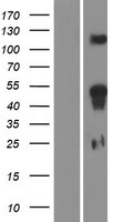 ls003237 hoxd11 human over expression lysates nm 021192 wb testing 1