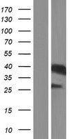 Haptoglobin (HP) Human Over-expression Lysates NM_001126102