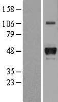 Haptoglobin (HP) Human Over-expression Lysates NM_005143