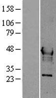 Hepsin (HPN) Human Over-expression Lysates NM_002151