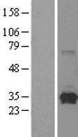 HPRT (HPRT1) Human Over-expression Lysates NM_000194