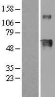 Hemopexin (HPX) Human Over-expression Lysates NM_000613