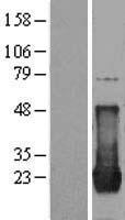 p21 Ras (HRAS) Human Over-expression Lysates NM_001130442